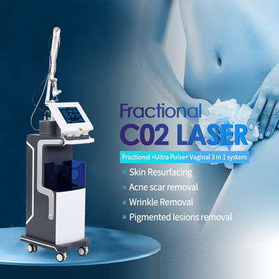CO2-fractionele lasermachine De meest geavanceerde oplossing voor littekenverwijdering