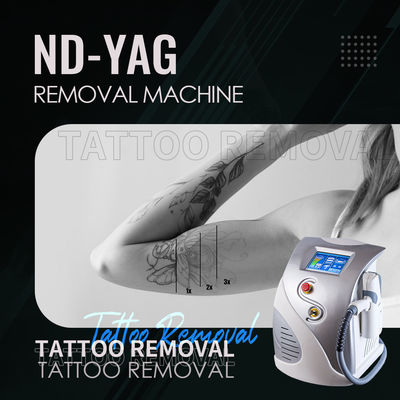 ND YAG Laser 1064nm 532nm tatoeage verwijdering machine 1320nm Carbon Peeling
